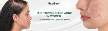 Hair Thinning and Acne in Women: Are Hormones, Stress, or Diet to Blame?