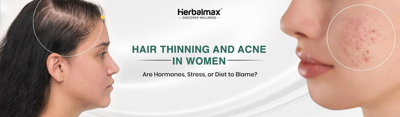 Hair Thinning and Acne in Women: Are Hormones, Stress, or Diet to Blame?