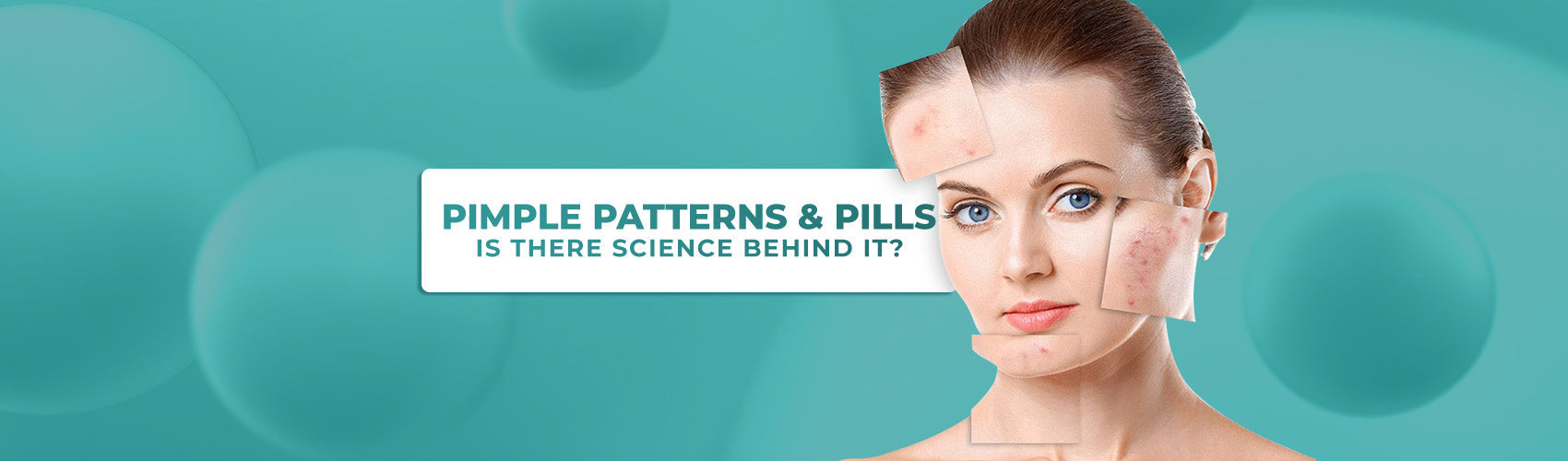 Pimple Patterns And Pills: Is There Science Behind It?