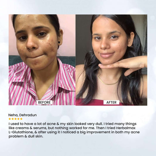 L-Glutathione (Pack of 4) Tablets for Glowing Skin & Even Tone – Long-Term Care Pack