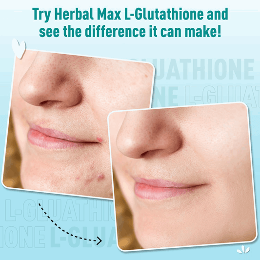 L-Glutathione-for Skin