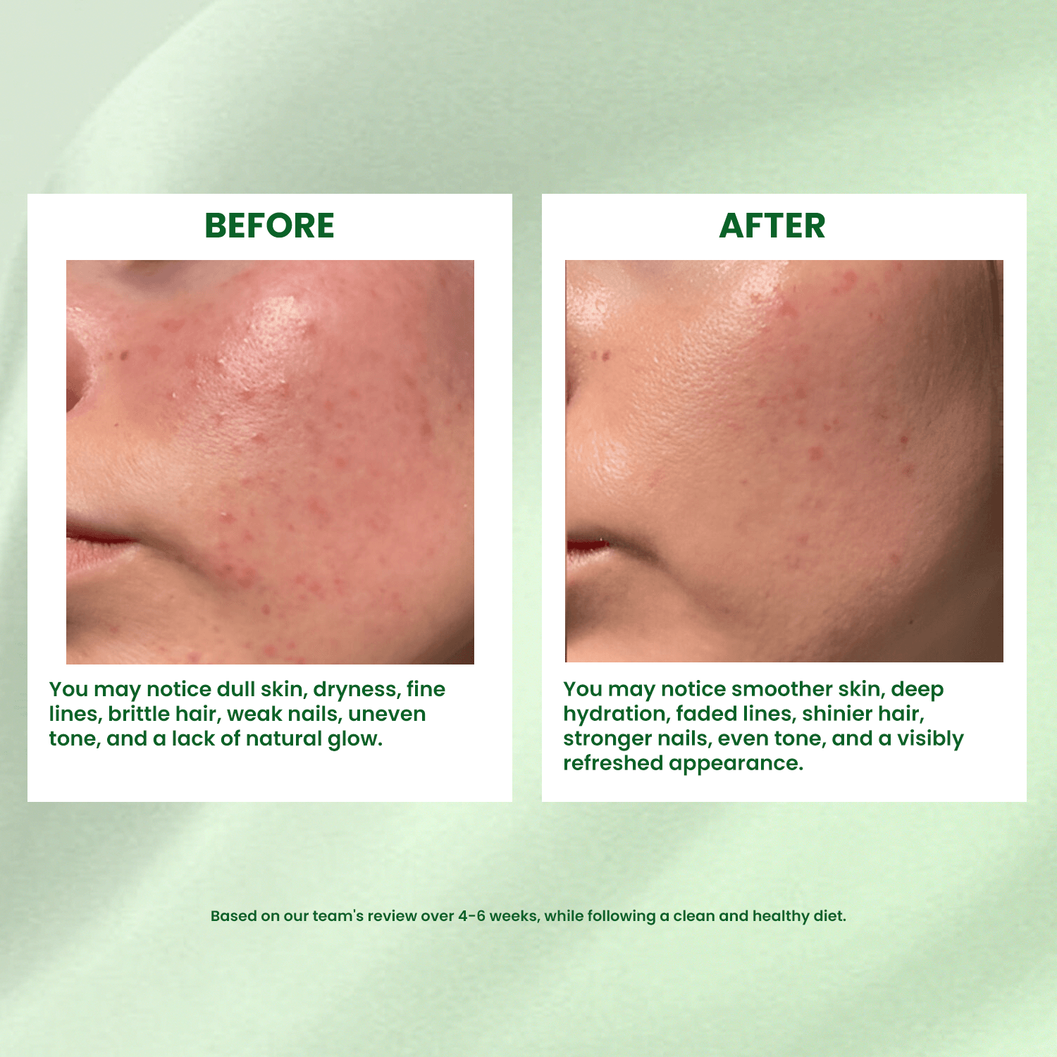 buy plant based collagen Collagen for glowing skin