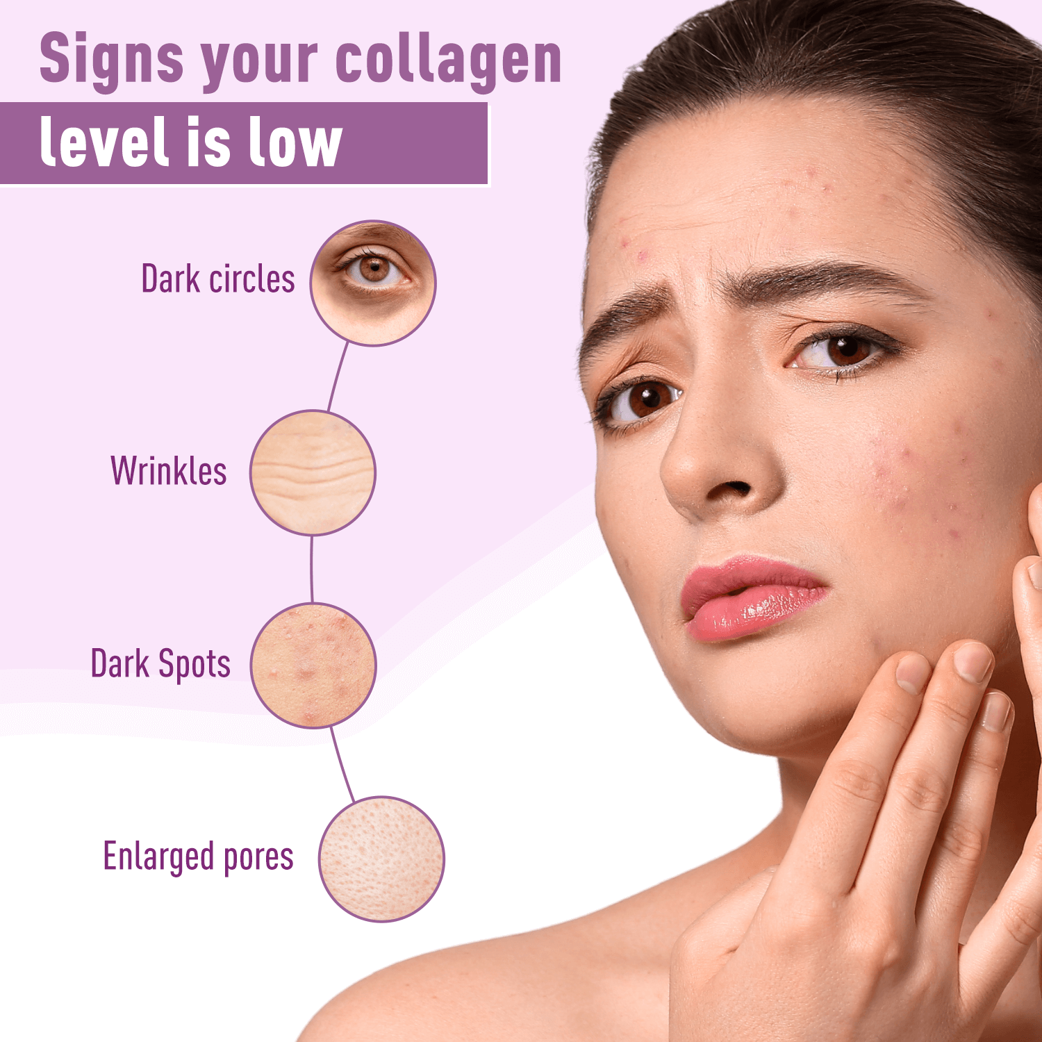 collagen for skin